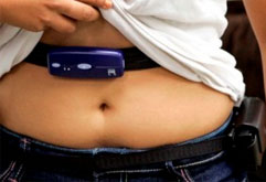 World Obesity Day: TOP 5 tips to keep obesity away 