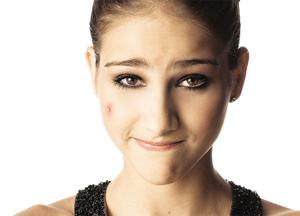 Cure acne without elaborate face packs